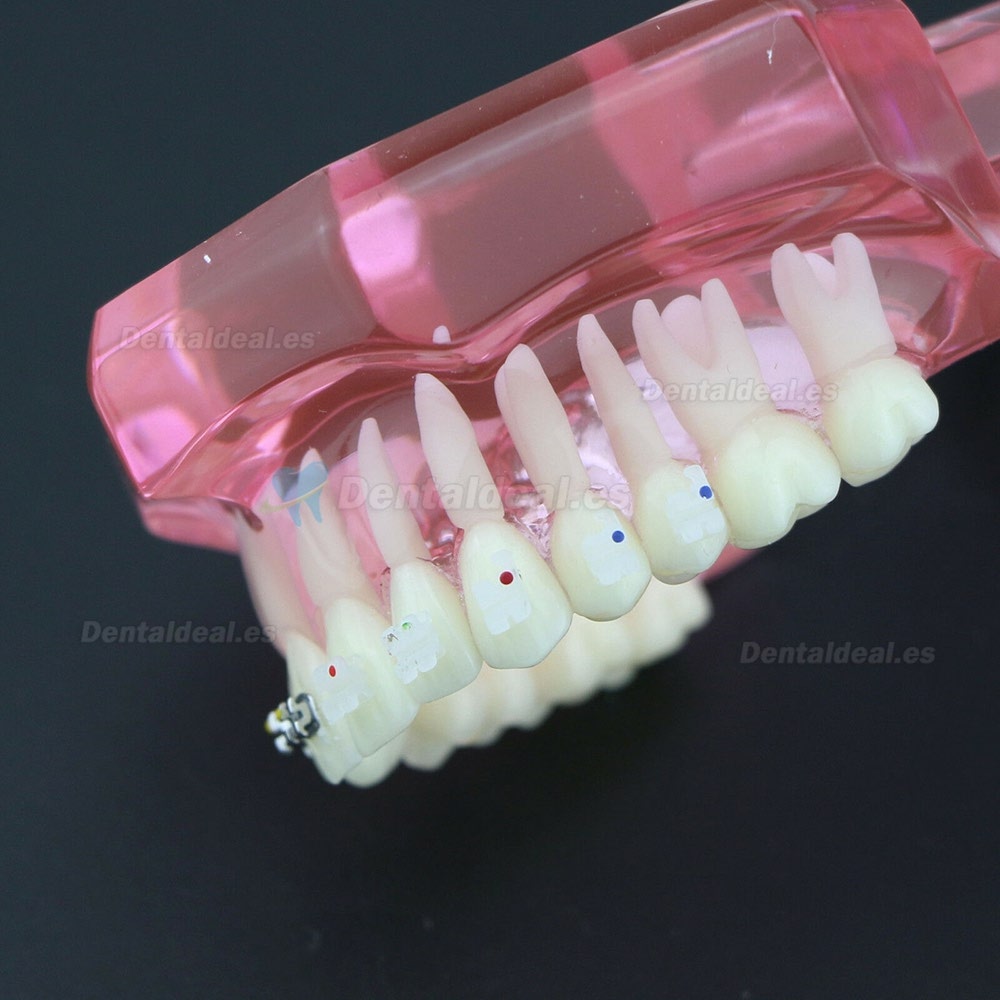 Dientes de ortodoncia dental Modelo de metal y soporte de cerámica Braces estudio modelo 3003