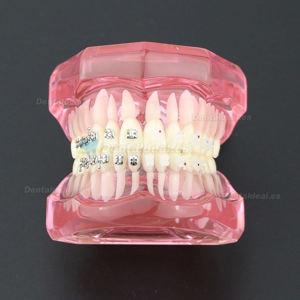 Dientes de ortodoncia dental Modelo de metal y soporte de cerámica Braces estudio modelo 3003