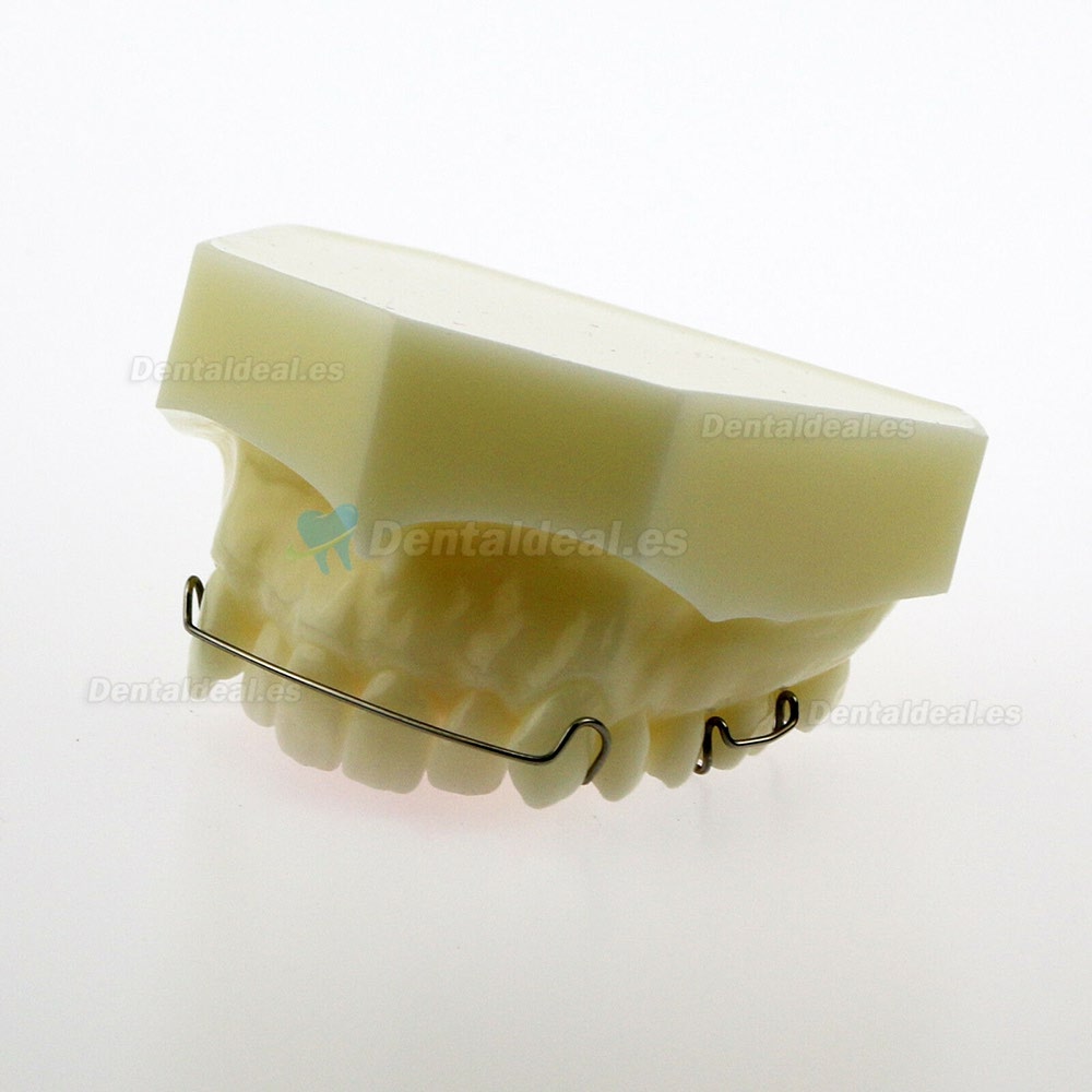 Modelo Dental Hawley Retainer Modelo # 3007 01