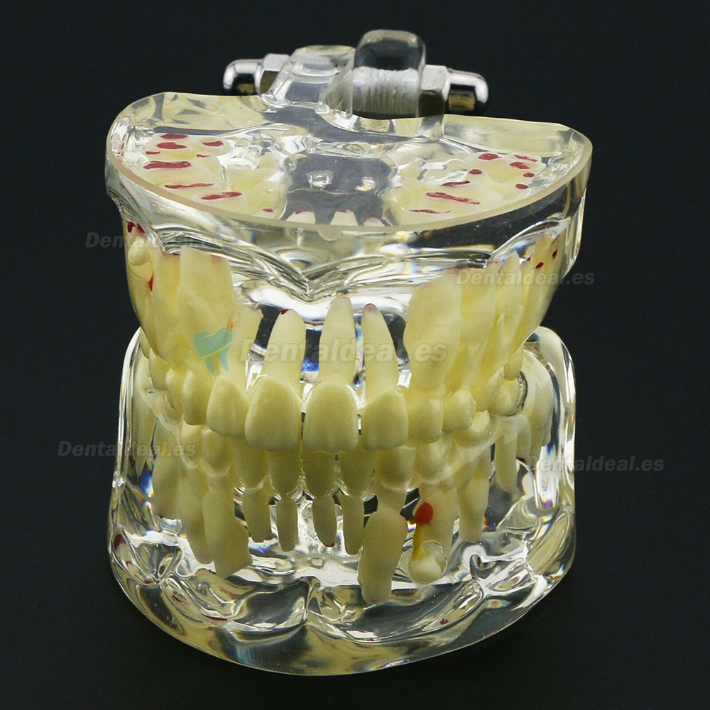 Modelo de Estudio de Demostración de Patología Pediátrica de Dientes de Niños Dentales 4002