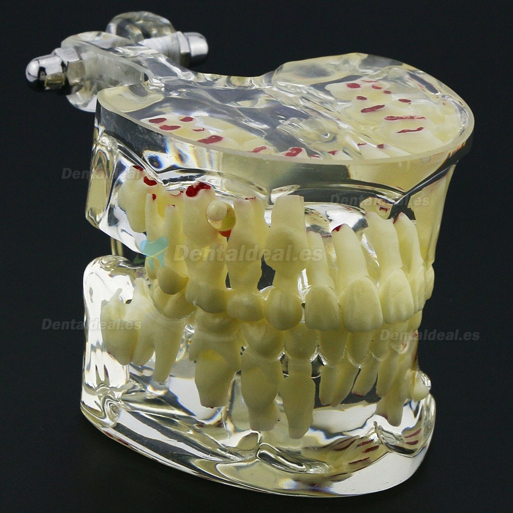 Modelo de Estudio de Demostración de Patología Pediátrica de Dientes de Niños Dentales 4002