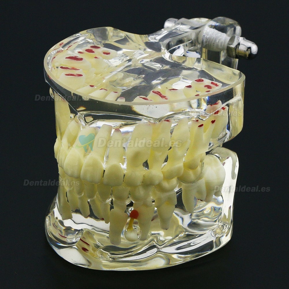 Modelo de Estudio de Demostración de Patología Pediátrica de Dientes de Niños Dentales 4002