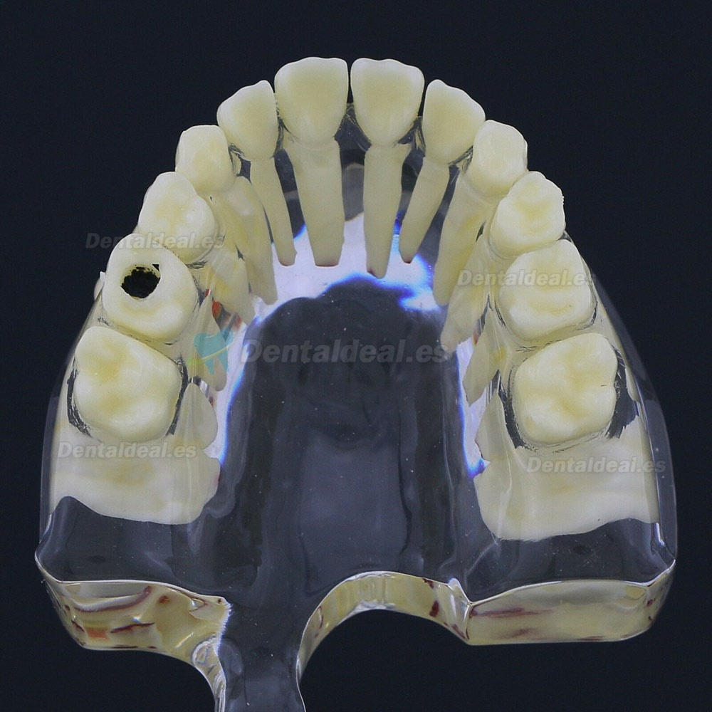 Modelo de Estudio de Demostración de Patología Pediátrica de Dientes de Niños Dentales 4002