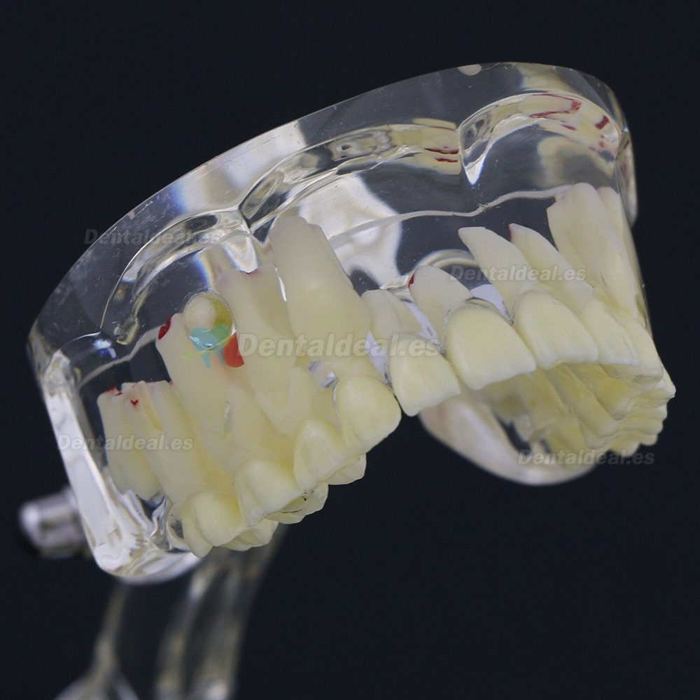 Modelo de Estudio de Demostración de Patología Pediátrica de Dientes de Niños Dentales 4002