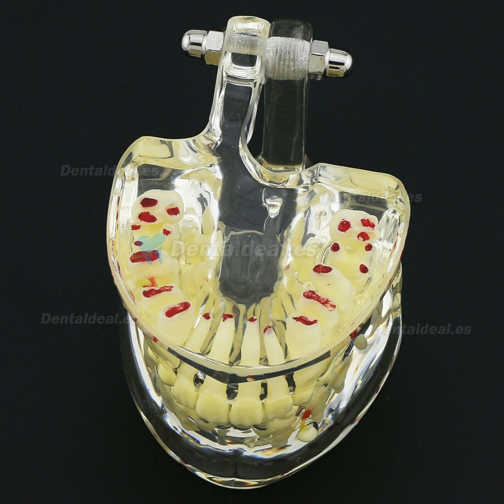 Modelo de Estudio de Demostración de Patología Pediátrica de Dientes de Niños Dentales 4002