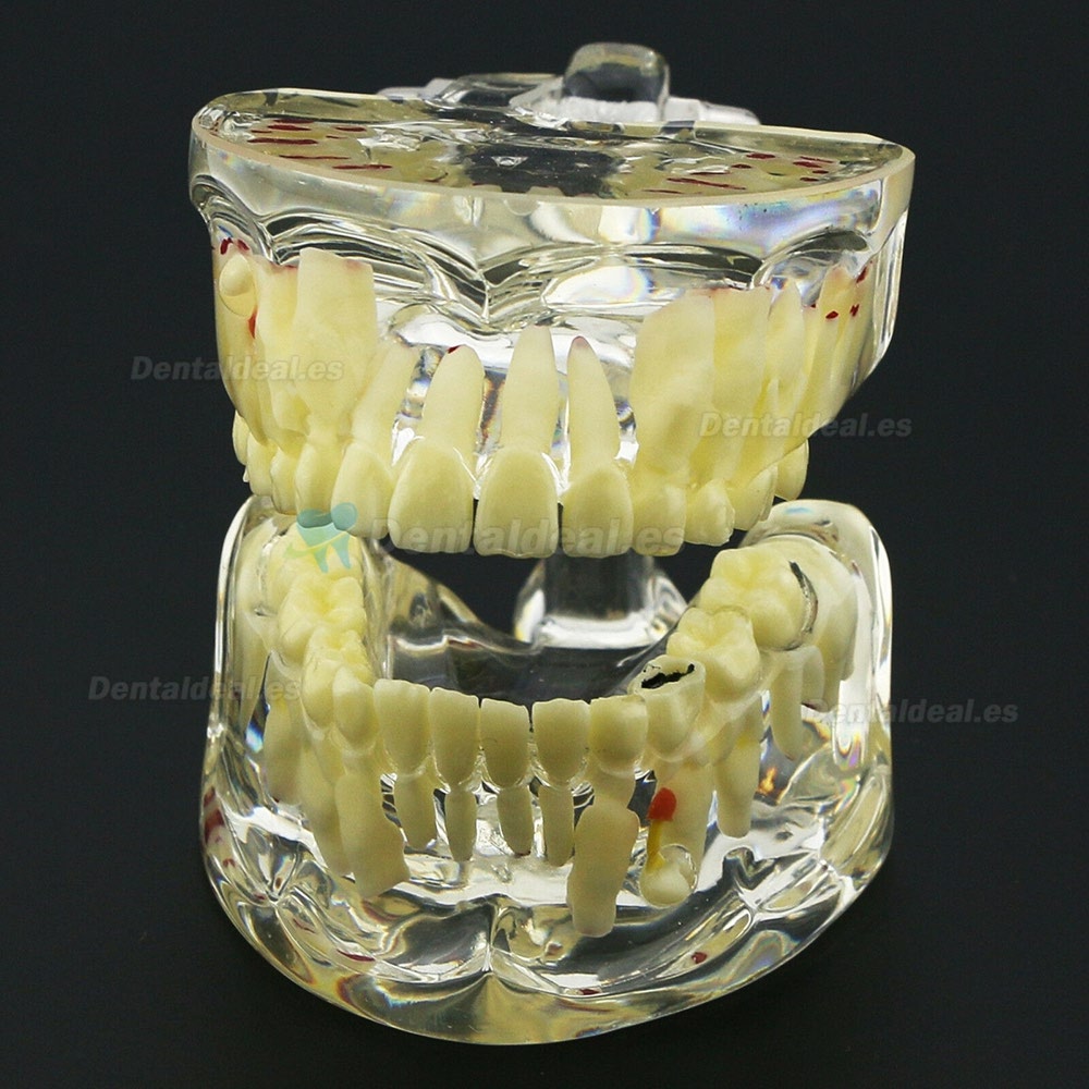 Modelo de Estudio de Demostración de Patología Pediátrica de Dientes de Niños Dentales 4002