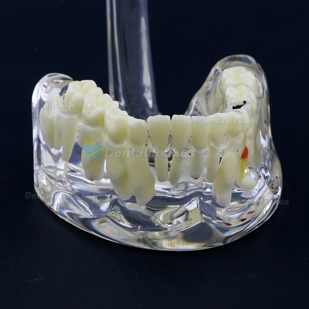 Nuevo estudio de demostración de patología pediátrica para niños dentales, modelo 4002