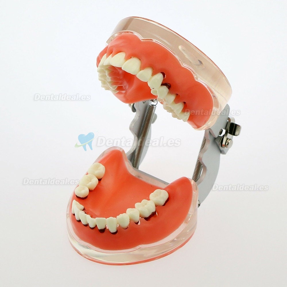 Modelo dental Estudio de la enfermedad periodontal patológica en adultos Modelo de dientes 4017