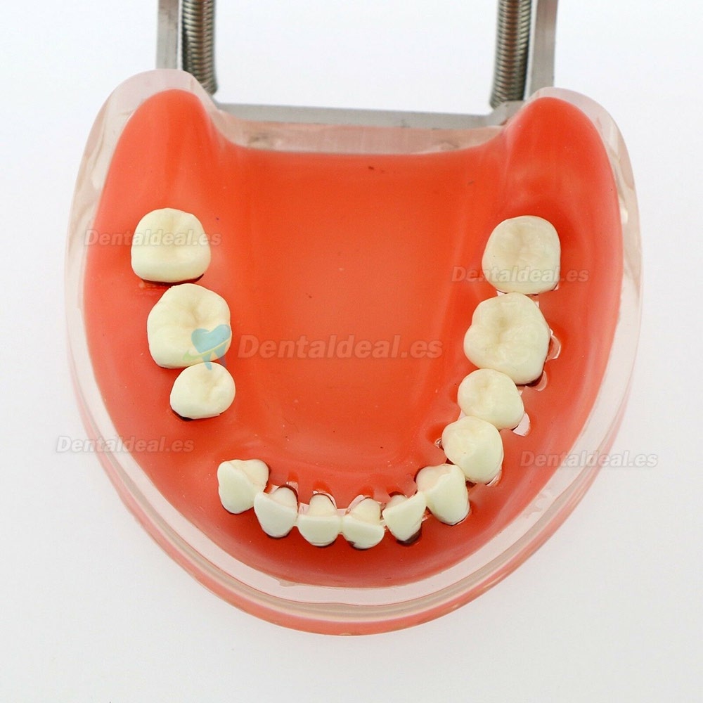 Modelo dental Estudio de la enfermedad periodontal patológica en adultos Modelo de dientes 4017