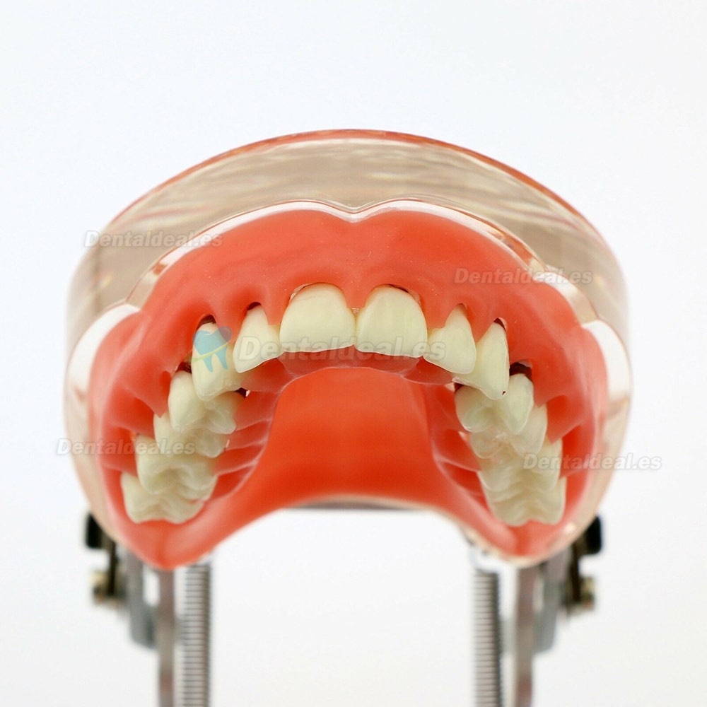 Modelo dental Estudio de la enfermedad periodontal patológica en adultos Modelo de dientes 4017