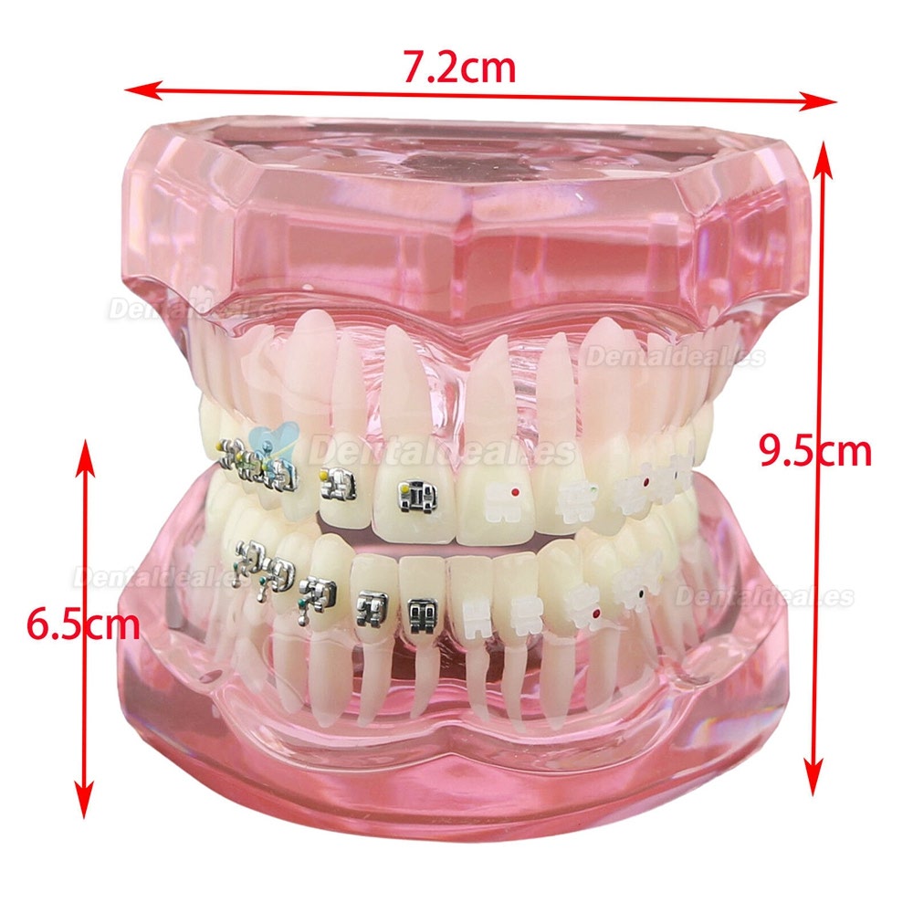 Dental Ortodoncia Dientes modelo + tubo de soporte de cerámica de metal Cadena autoligante