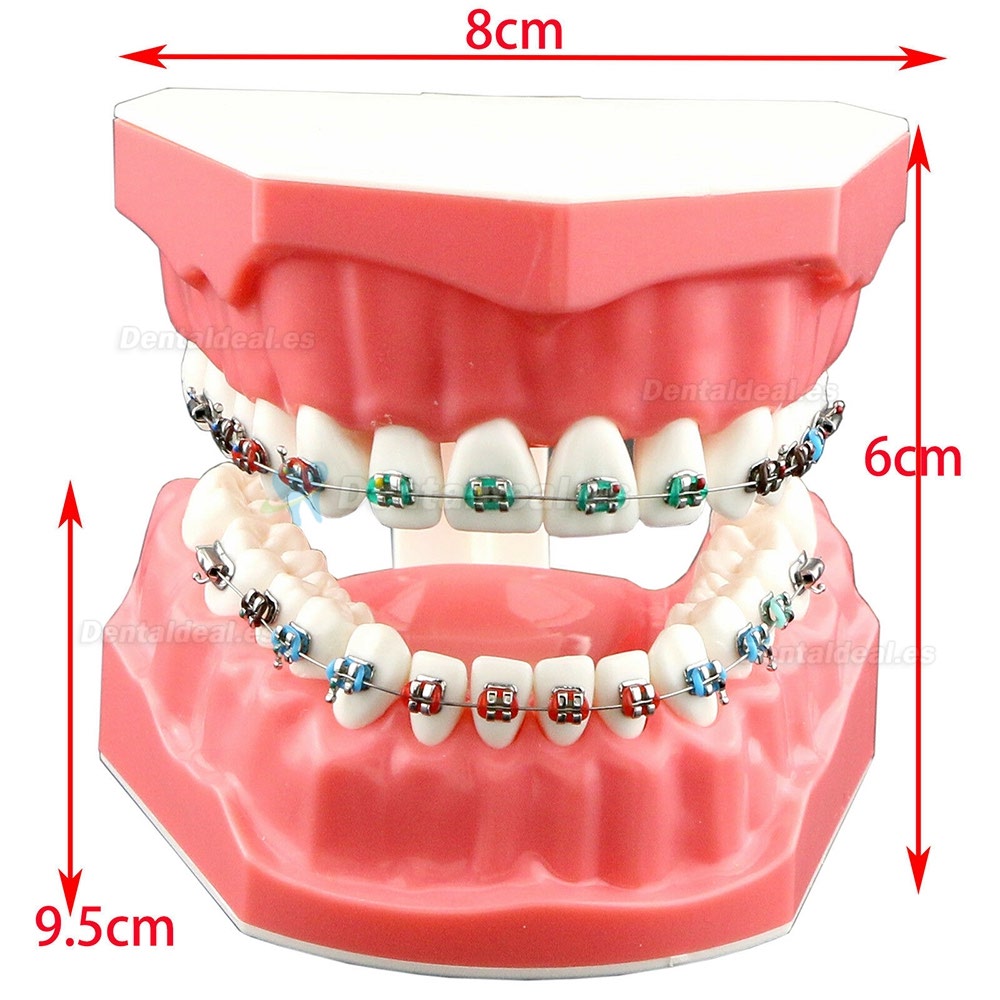 Dental Ortodoncia Dientes modelo + tubo de soporte de cerámica de metal Cadena autoligante