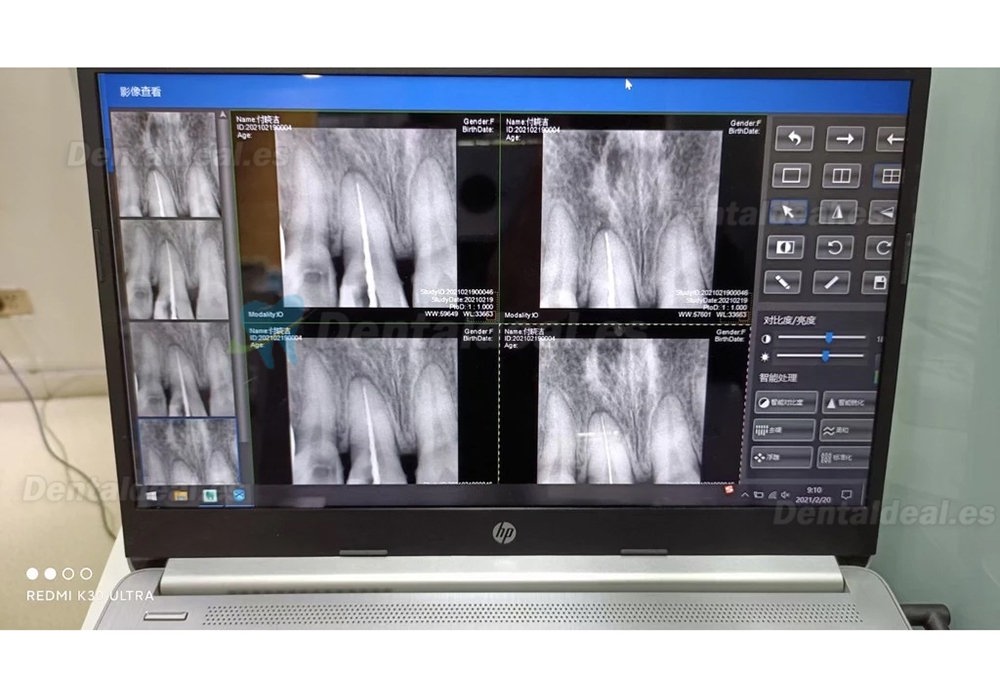 Sensor de Rayos X de Imagen Digital Dental RVG Sistema de Imágenes Intraorales Dentales