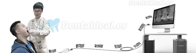 Sensor de Rayos X de Imagen Digital Dental RVG Sistema de Imágenes Intraorales Dentales