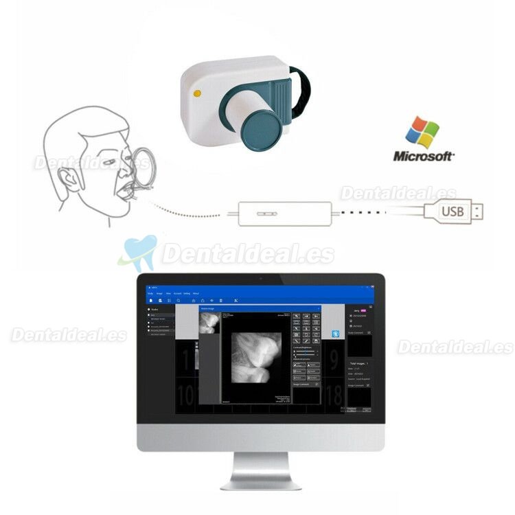 Sensor de Rayos X de Imagen Digital Dental RVG Sistema de Imágenes Intraorales Dentales