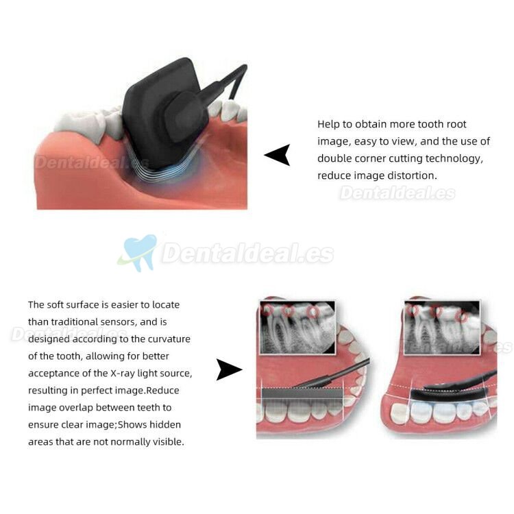 Sensor de Rayos X de Imagen Digital Dental RVG Sistema de Imágenes Intraorales Dentales
