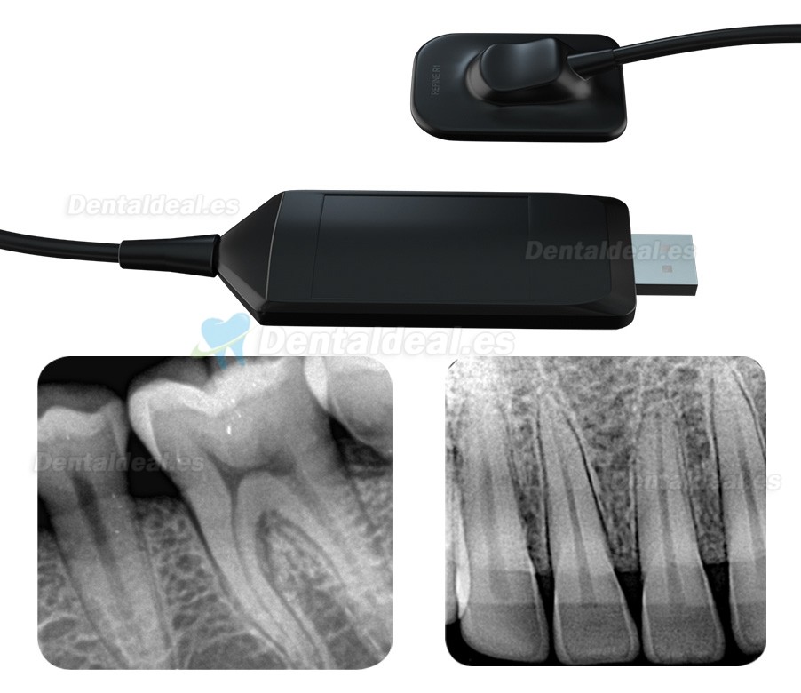 Refine VeRay unidad de rayos x dental portátil + kit de sensor intraoral de rayos x dental