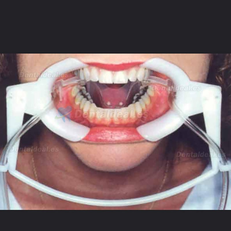 1Pcs Retractor de mejillas dentales con tubo de succión subsaliva abridor de labios intraoral