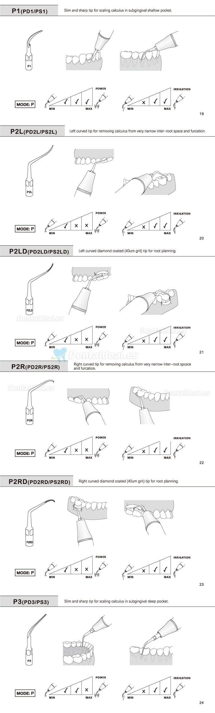 5Pcs Puntas de ultrasonido para periodoncia P2L P2R P2LD P2RD P5 P6 P7 P8 P10 P11 P12 P14L compatible con Refine EMS Woodpecker