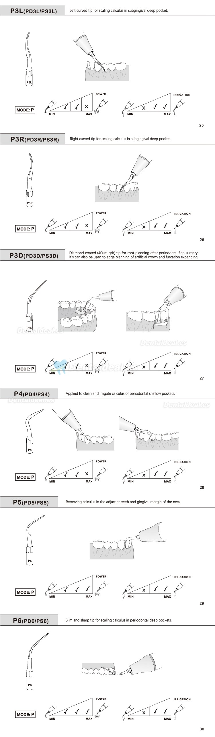 5Pcs Puntas de ultrasonido para periodoncia P2L P2R P2LD P2RD P5 P6 P7 P8 P10 P11 P12 P14L compatible con Refine EMS Woodpecker