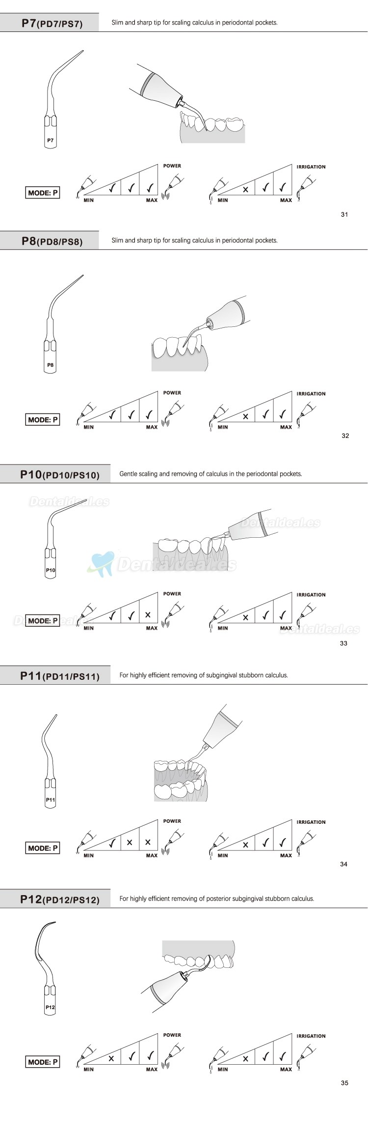 5Pcs Puntas de ultrasonido para periodoncia P2L P2R P2LD P2RD P5 P6 P7 P8 P10 P11 P12 P14L compatible con Refine EMS Woodpecker