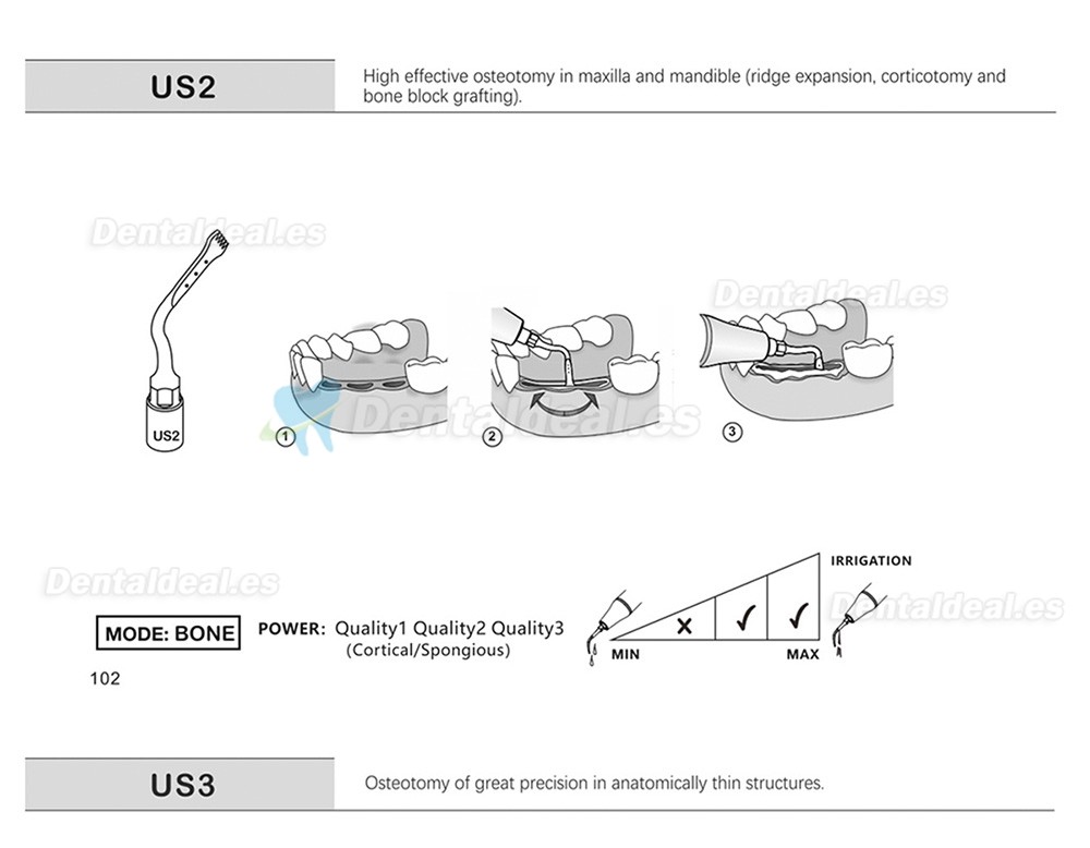 1Pcs Punta Ultrasurgery US1 US1L US1R US2 US3 US4 US5 US6 US7 US11 US12 compatible con Mectron Woodpecker