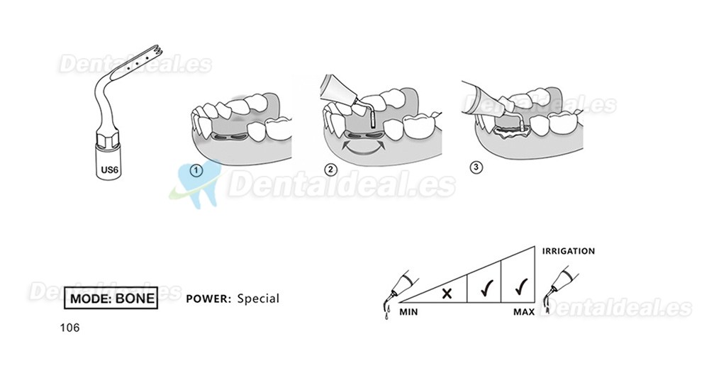 1Pcs Punta Ultrasurgery US1 US1L US1R US2 US3 US4 US5 US6 US7 US11 US12 compatible con Mectron Woodpecker