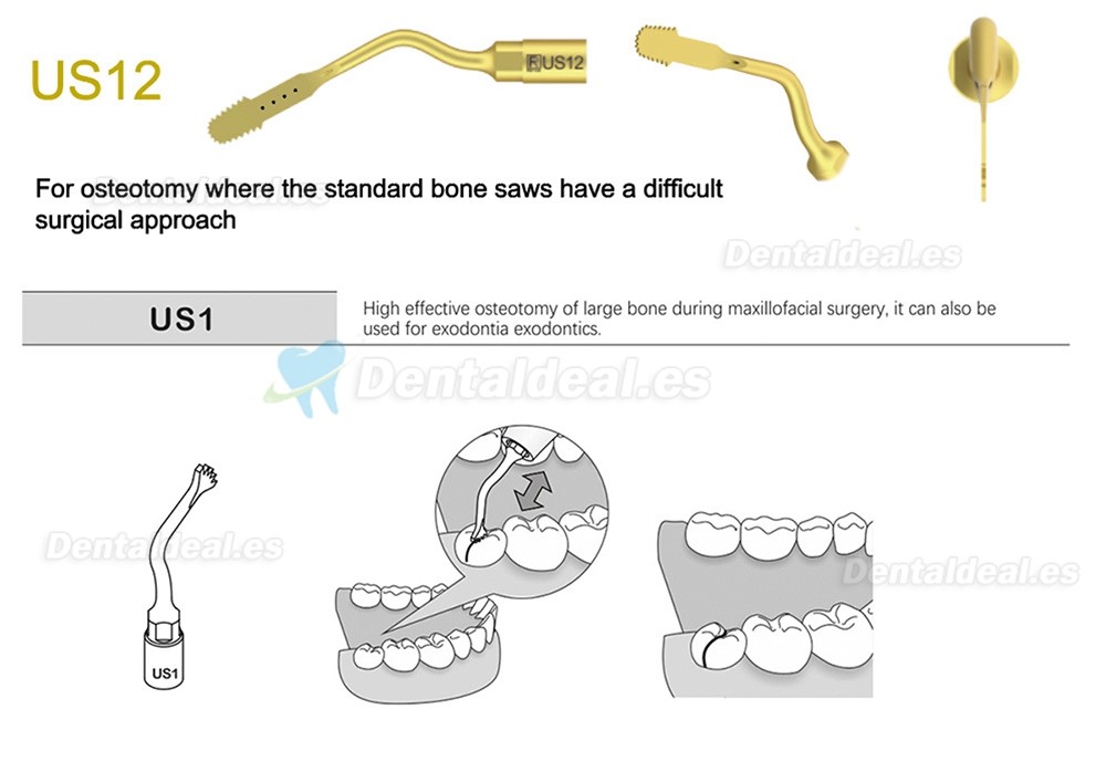 1Pcs Punta Ultrasurgery US1 US1L US1R US2 US3 US4 US5 US6 US7 US11 US12 compatible con Mectron Woodpecker