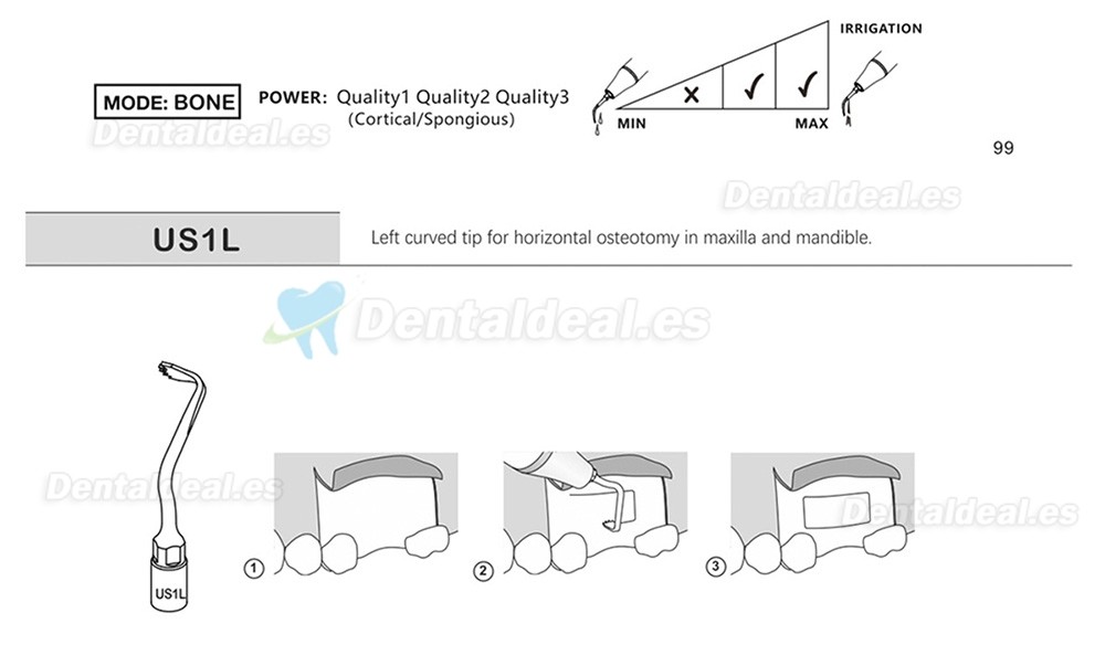 1Pcs Punta Ultrasurgery US1 US1L US1R US2 US3 US4 US5 US6 US7 US11 US12 compatible con Mectron Woodpecker