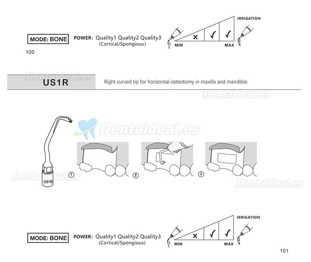 1Pcs Punta Ultrasurgery US1 US1L US1R US2 US3 US4 US5 US6 US7 US11 US12 compatible con Mectron Woodpecker