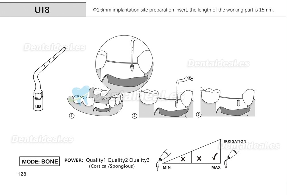 1Pcs Puntas para piezo cirugía para implante de elevación de seno para corte óseo Ul1 UI2 UI3 UI4 UI5 compatible con Mectron Woodpecker