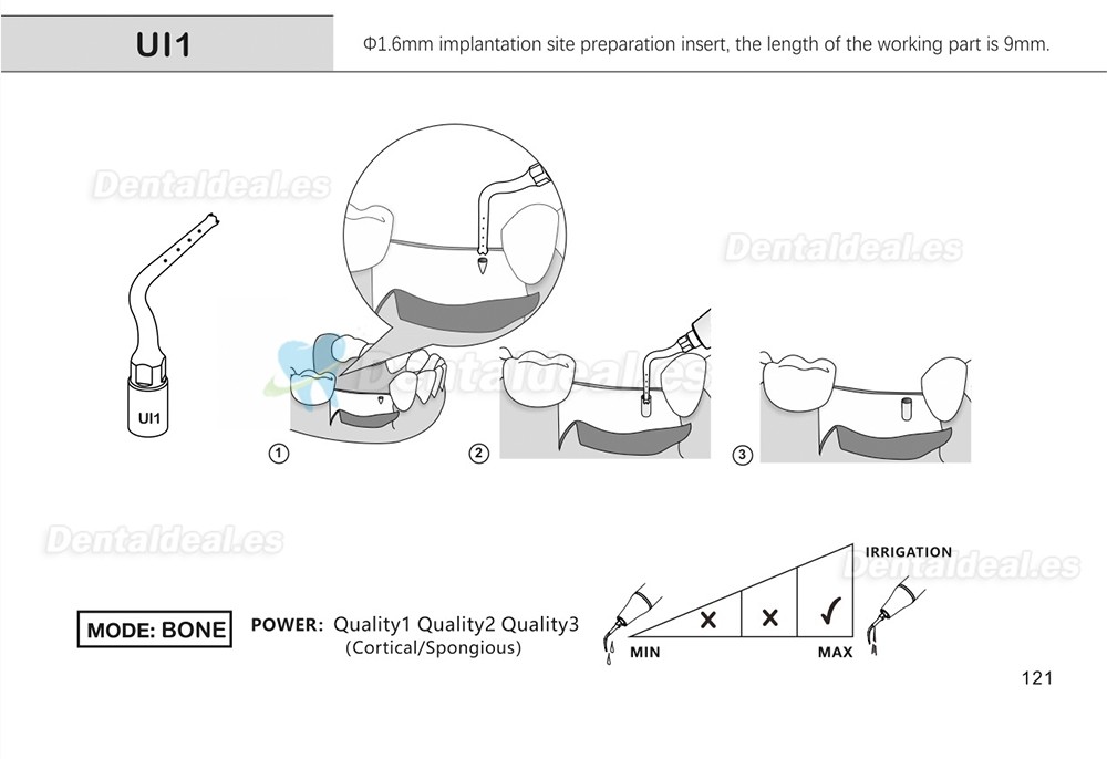 1Pcs Puntas para piezo cirugía para implante de elevación de seno para corte óseo Ul1 UI2 UI3 UI4 UI5 compatible con Mectron Woodpecker