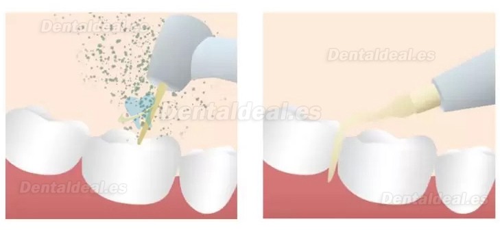 Refine MaxSurgery máquina de cirugía piezoeléctrica dental sistema de cirugía ósea piezoeléctrica ultrasónica 