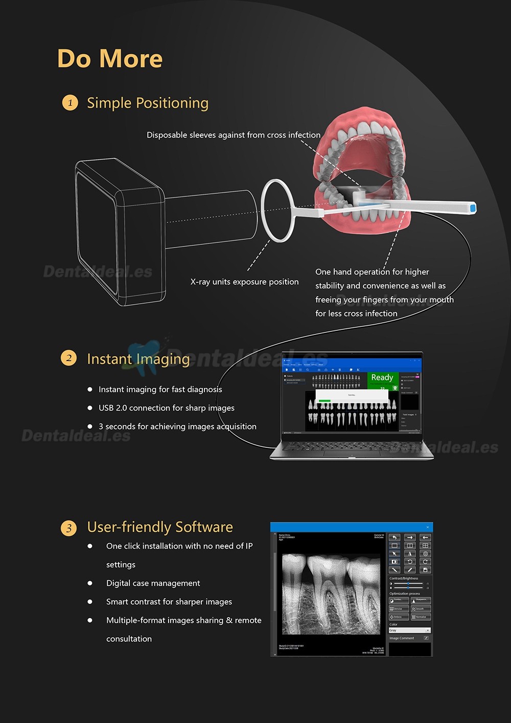 Sensor de Rayos X de Imagen Digital Dental RVG Sistema de Imágenes Intraorales Dentales