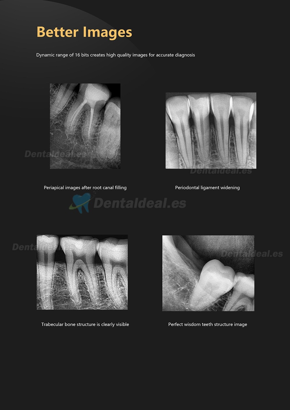 Sensor de Rayos X de Imagen Digital Dental RVG Sistema de Imágenes Intraorales Dentales