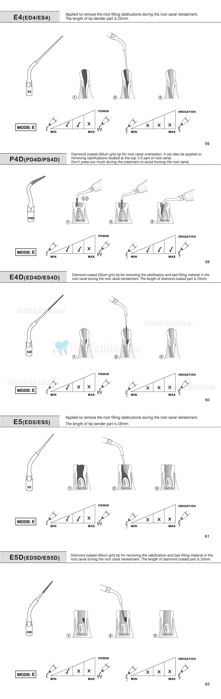 5Pcs Punta ultrasonidos para implantes E1 E2 E3 E4 E4 E6 E7 E8 E9 E10 E11 E14 E15 compatible con REFINE EMS MECTRON WOODPECKER